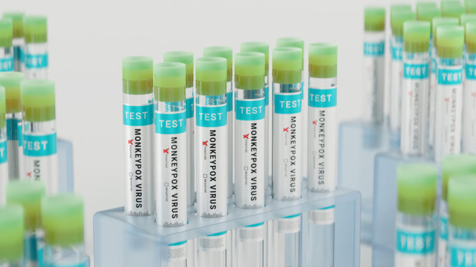Variole du singe : les tests de détection bientôt remboursés