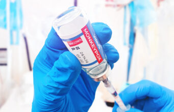 Variole du singe : ouverture d’un vaccinodrome à Paris