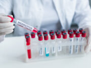 Variole du singe : un nouveau symptôme touche les yeux