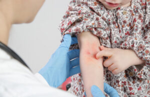 Le Kanuka : cette plante de Nouvelle-Zélande soigne l’eczéma