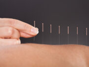 À quoi sert l’acupuncture ?