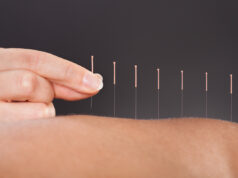 À quoi sert l’acupuncture ?