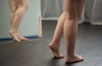 Comment soulager les jambes lourdes ?