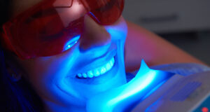 Beaucoup de produits pour du blanchiment dentaire seraient dangereux ou inutiles