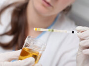 Ce que la couleur de vos urines dit de votre santé