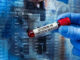 Covid-19 : feu vert pour trois vaccins adaptés à Omicron