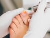Mycose de l’ongle de pied : diagnostic, symptômes et traitement