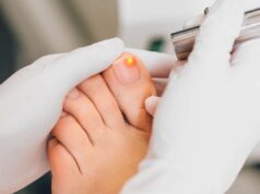 Mycose de l’ongle de pied : diagnostic, symptômes et traitement