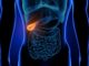 Inflammation de la vésicule biliaire: quels sont les symptômes ?