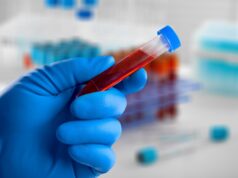 Bipolaire ou dépressif ? Un test sanguin fera bientôt la différence
