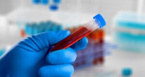 Bipolaire ou dépressif ? Un test sanguin fera bientôt la différence