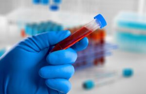 Bipolaire ou dépressif ? Un test sanguin fera bientôt la différence