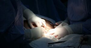 Accouchement par césarienne