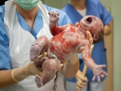 L’expulsion du bébé