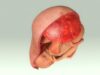 Le placenta