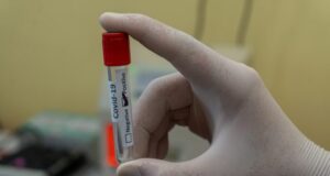 COVID-19 : les laboratoires pris d’assaut