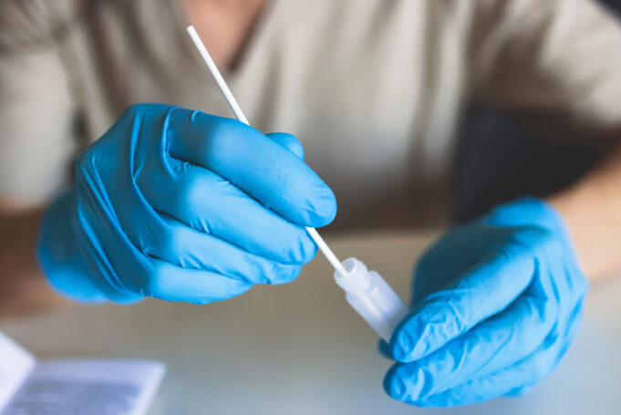 Ou faire un test antigénique ?