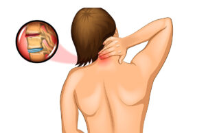 Névralgie cervico-brachiale et cancer : Y a t-il un lien ?