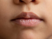 4 astuces pour éviter les gerçures en hiver