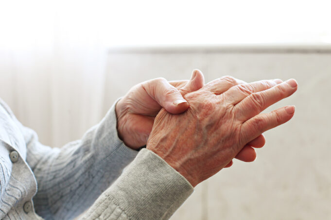 Arthrose de la main : bientôt un nouveau médicament anti-inflammatoire ?