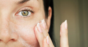 Comment lutter contre la peau sèche ?