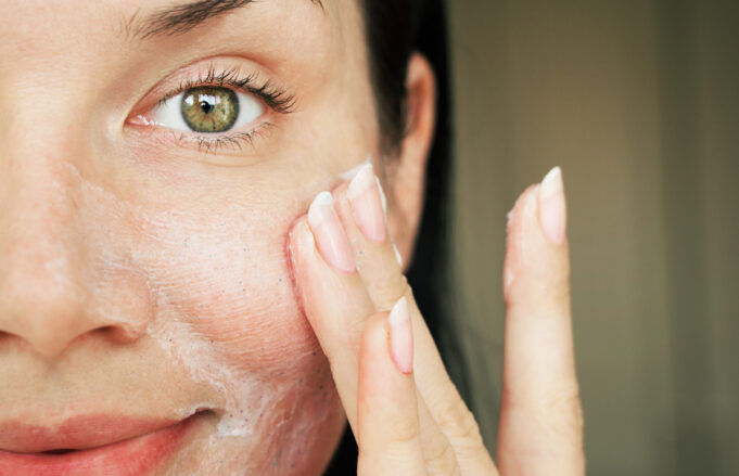 Comment lutter contre la peau sèche ?