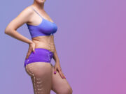 Chirurgie esthétique : la liposuccion en tête