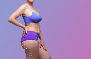 Chirurgie esthétique : la liposuccion en tête