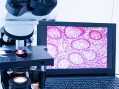 Première mondiale : une intelligence artificielle dans le diagnostic du cancer du sein