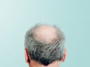 Les boissons sucrées peuvent vous faire perdre vos cheveux