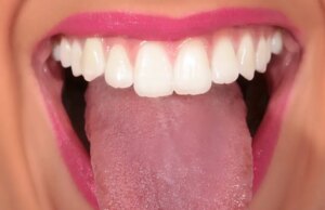 Tirez la langue : elle révèle votre état de santé