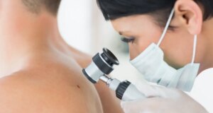 Quels sont les premiers signes d’un cancer de la peau ?