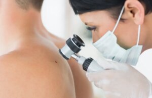 Quels sont les premiers signes d’un cancer de la peau ?