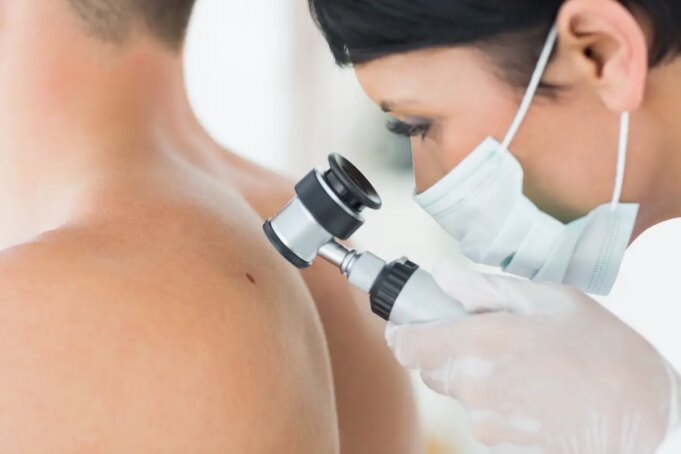 Quels sont les premiers signes d’un cancer de la peau ?