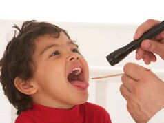 Amygdale gonflée : cause et traitement