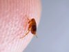 piqûre de puce : Comment la reconnaître et la soigner ?