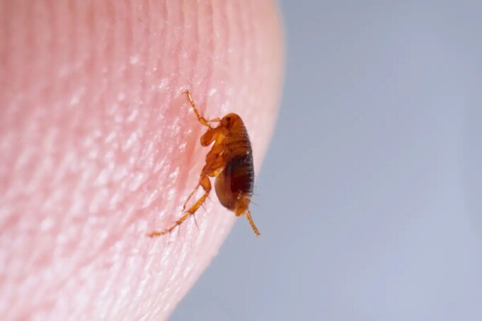piqûre de puce : Comment la reconnaître et la soigner ?