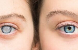 Un YouTubeur paye l’opération de la cataracte à un millier de personnes