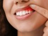 Pourquoi une mauvaise hygiène dentaire peut avoir des conséquences sur votre santé ?