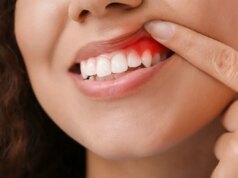 Pourquoi une mauvaise hygiène dentaire peut avoir des conséquences sur votre santé ?