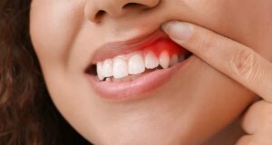 Pourquoi une mauvaise hygiène dentaire peut avoir des conséquences sur votre santé ?