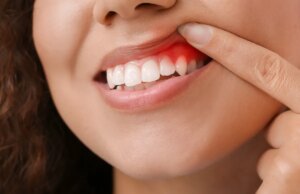 Pourquoi une mauvaise hygiène dentaire peut avoir des conséquences sur votre santé ?