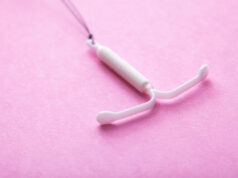 Les stérilets hormonaux augmentent les troubles dépressifs