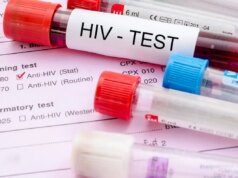 Santé : un troisième cas de guérison du VIH