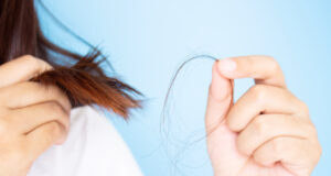 5 astuces pour empêcher la chute des cheveux