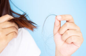 5 astuces pour empêcher la chute des cheveux