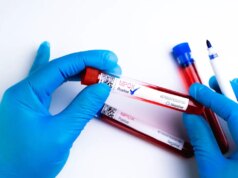 Variole du singe : une forme mortelle identifiée chez certains patients