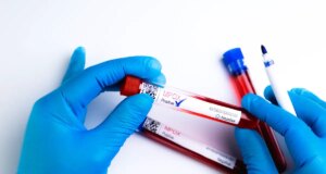 Variole du singe : une forme mortelle identifiée chez certains patients