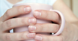 D’où viennent les tâches blanches sur les ongles ?