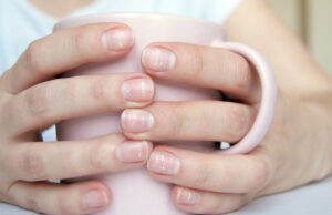 D’où viennent les tâches blanches sur les ongles ?